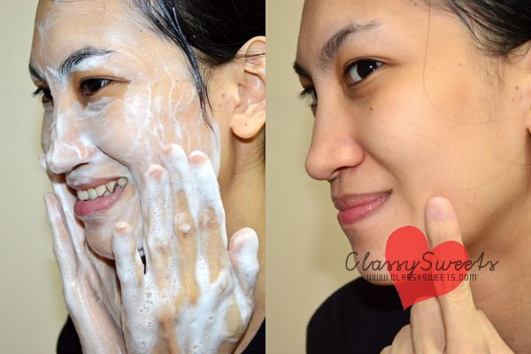 Ciracle Blackhead Soap: Your Key To A Blackhead-Free Face – CLASSY SWEETS